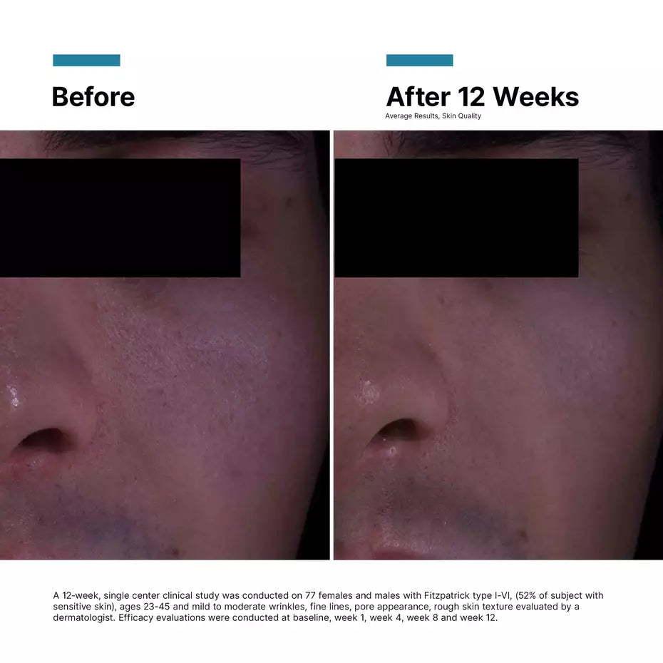 P-TIOX Anti-Wrinkle Cream