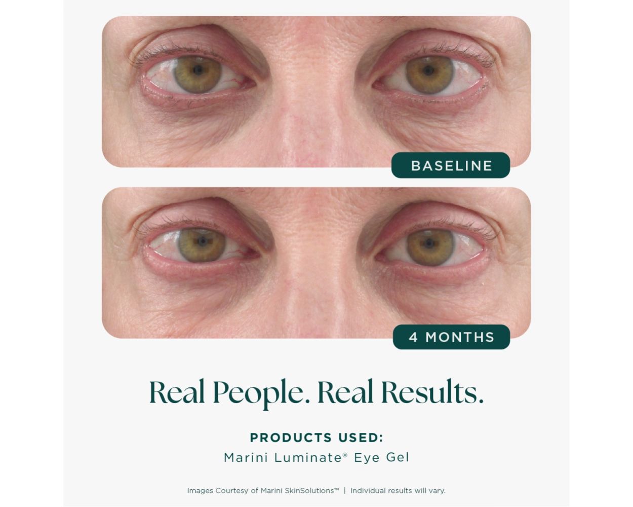 Marini Luminate® Eye Gel