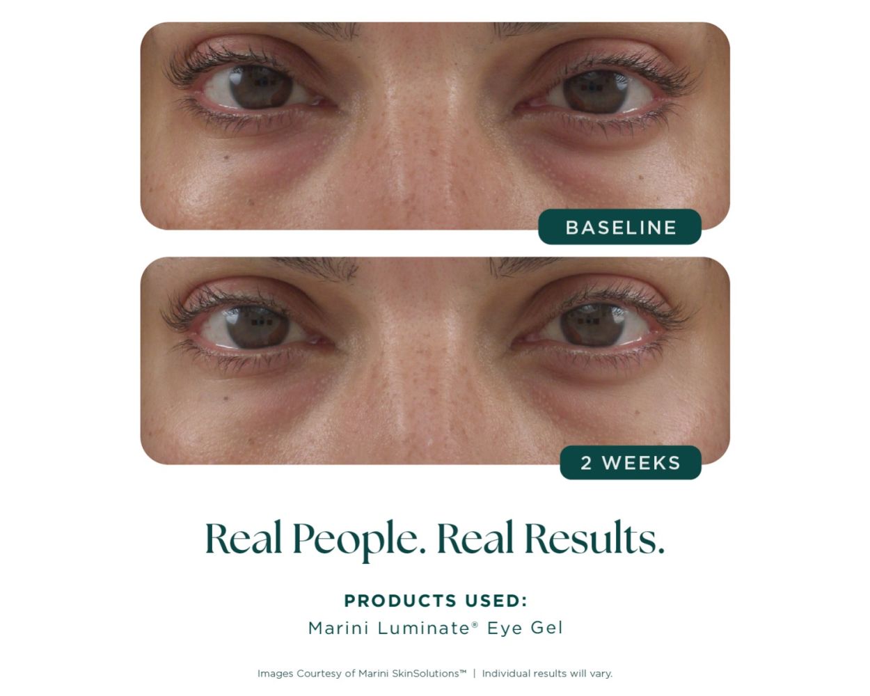 Marini Luminate® Eye Gel